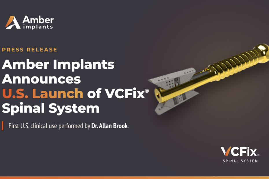 First U.S. Kyphoplasty Procedure Using the Amber Implants VCFix® Spinal System With Pedicle-Based Stabilization